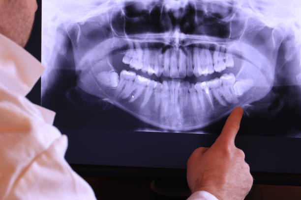 Best Emergency Treatment for Dental Infections or Abscesses in Amherst, TX